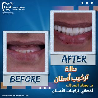 Cosmetic and dental services At First Dental Center